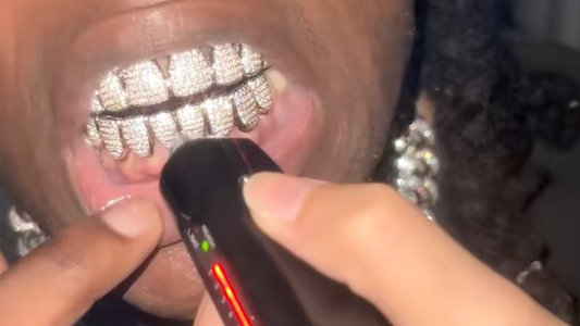 "Grillz That Shine Harder: The Story Behind a Custom Moissanite Iced-Out Smile"
